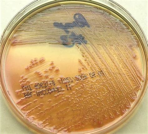 pseudomonas aeruginosa on macconkey agar|12.6.1: MacConkey Agar .